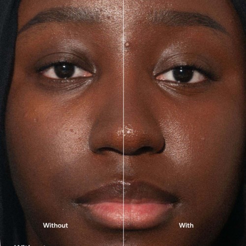 Close-up of a woman's face showing a side-by-side comparison of skin before and after applying skincare or makeup. No text.