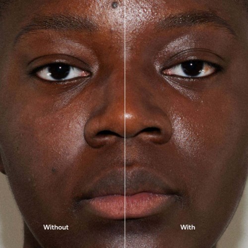 Comparison of a person's face showing skin before and after using a skincare product, with the words 'Without' and 'With'.