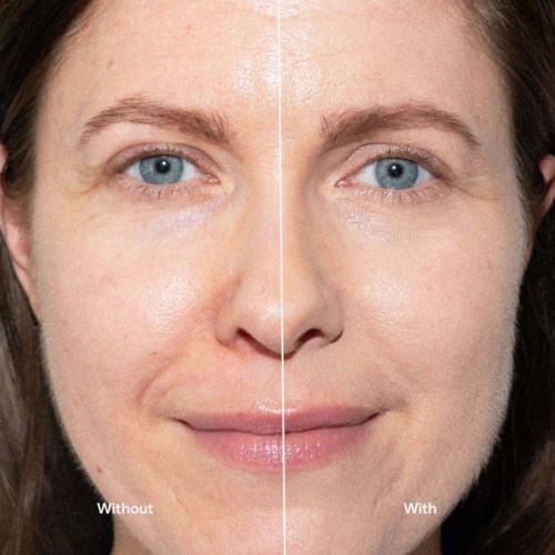 Split image showing a woman's face before and after skin improvement, with clearer, smoother skin on the right.