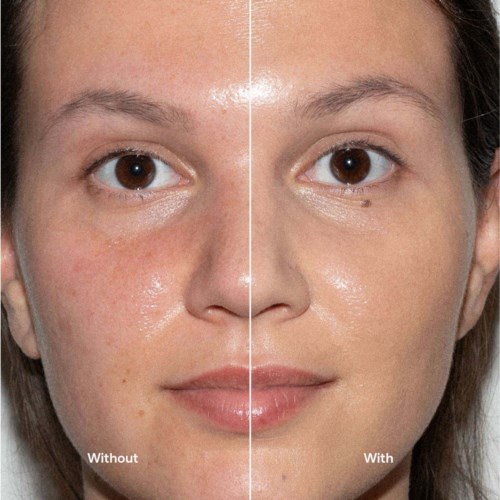 Side-by-side photo showing a woman's face before and after skincare improvements.