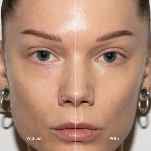 Split face comparison showing skin before and after skincare, with clear skin on the right side.