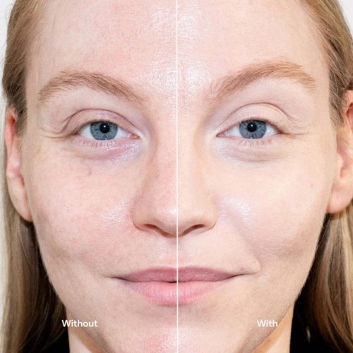 Before and after skincare comparison showing smoother, clearer skin on the right side of the face.