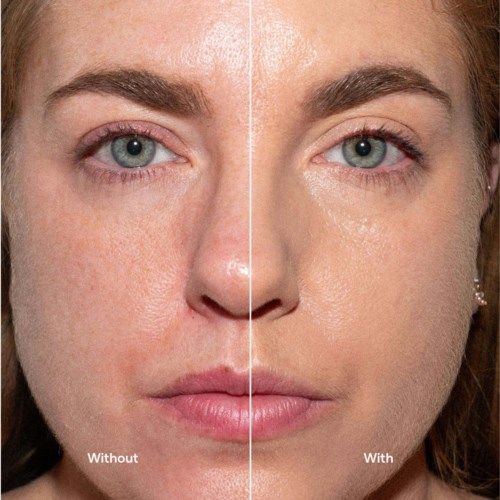 Comparison of a face before and after skincare, showing clearer and more radiant skin on the right side.
