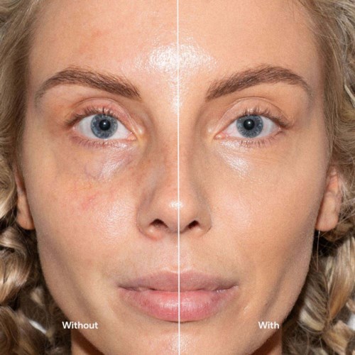 Side-by-side comparison of skin with and without a skincare product, showing improved skin clarity and texture.