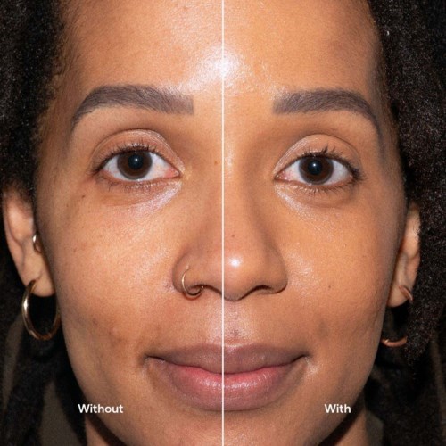 Side-by-side comparison of a woman's face, showing skin issues before and after using a skincare product.
