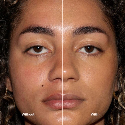 Side-by-side comparison of a woman’s face showing skin appearance before and after skincare.