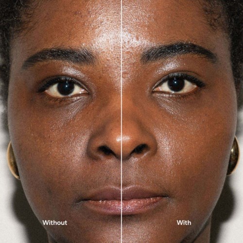 Comparison of a woman's face showing skin with and without makeup or skincare. Clearer, smoother skin on the right.
