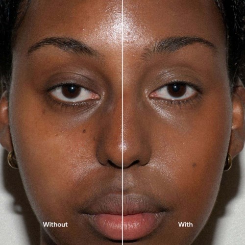 Side-by-side comparison of a woman's face, showing skin with and without skincare treatment.