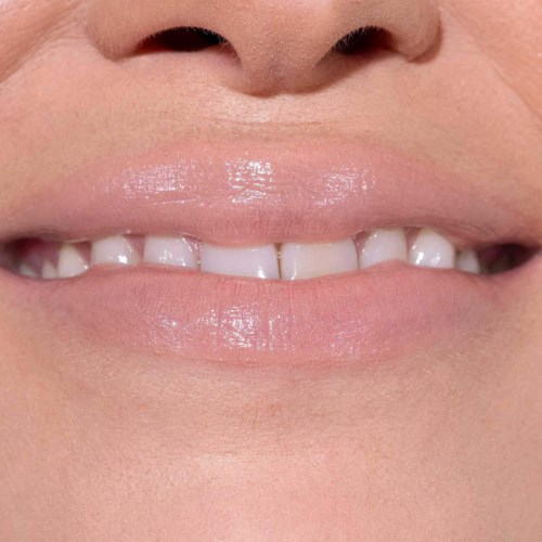 Nahaufnahme eines Lächelns mit sichtbaren Zähnen und glänzenden, glatten Lippen.
