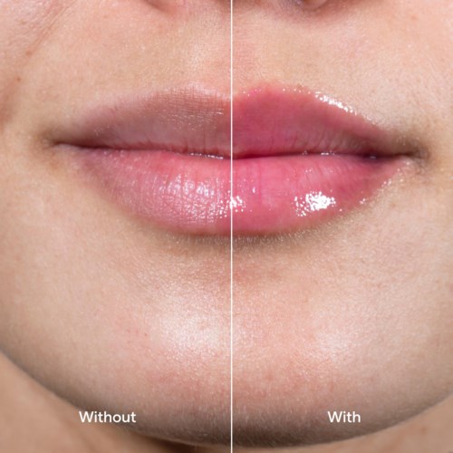 Nahaufnahme von Lippen, die Unterschiede mit und ohne Glanz oder Feuchtigkeitscreme zeigen. Die Lippen sehen auf der rechten Seite glänzender und glatter aus.