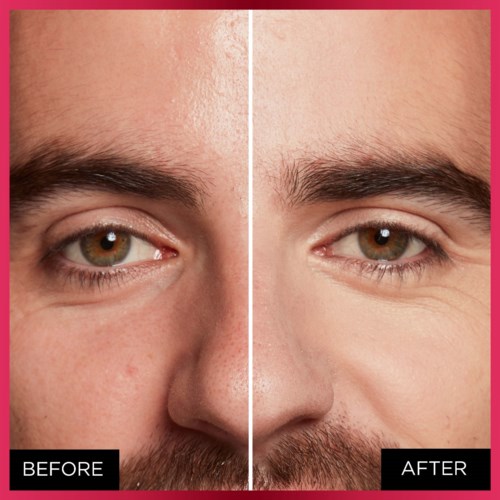 Side-by-side comparison of a man's skin, showing improvements after skincare or treatment. Clearly labeled 'Before' and 'After'.