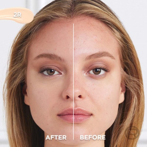 Split face showing skin improvements after treatment, with clear difference between before and after skin condition.
