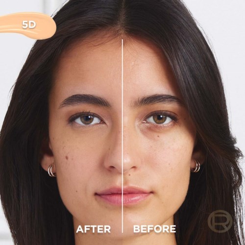 Split face showing clearer skin on the right side, with less blemishes compared to the left side.