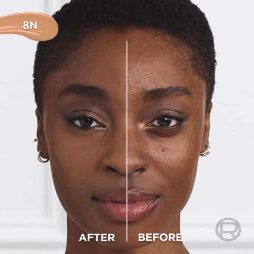 A woman's face shows clear skin on one side and blemished skin on the other, with text 'AFTER' and 'BEFORE'.
