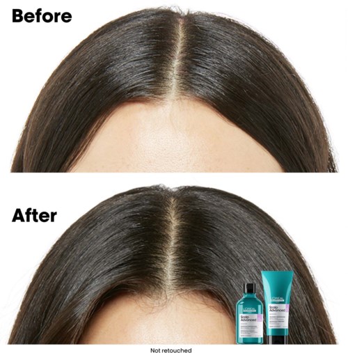 Hair looks thicker and shinier in the after photo, with hair care products shown. The before photo shows thinner hair parts.