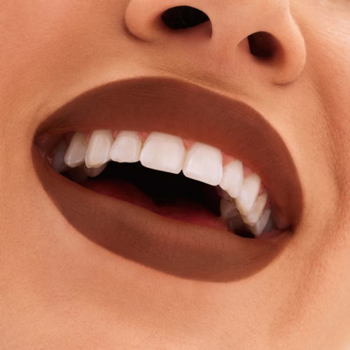 Nahaufnahme einer Person mit dunklem Lippenstift, die lächelt und weiße Zähne zeigt.