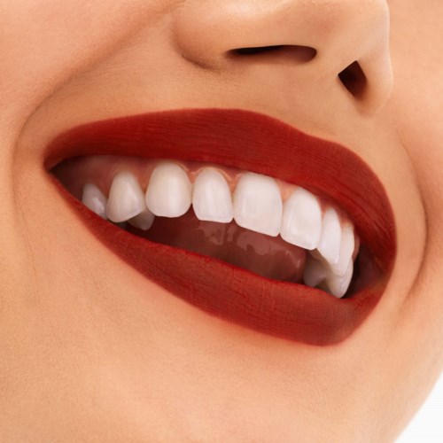 A person with red lipstick showing teeth, smiling with a close-up of the mouth and nose.
