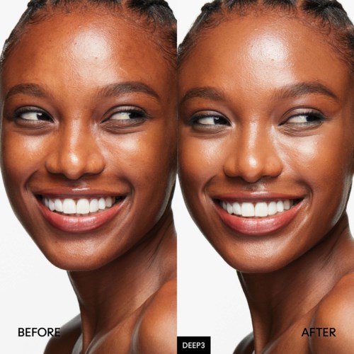 A side-by-side photo of a woman smiling before and after skin improvement, showing smoother, brighter skin in the second image.