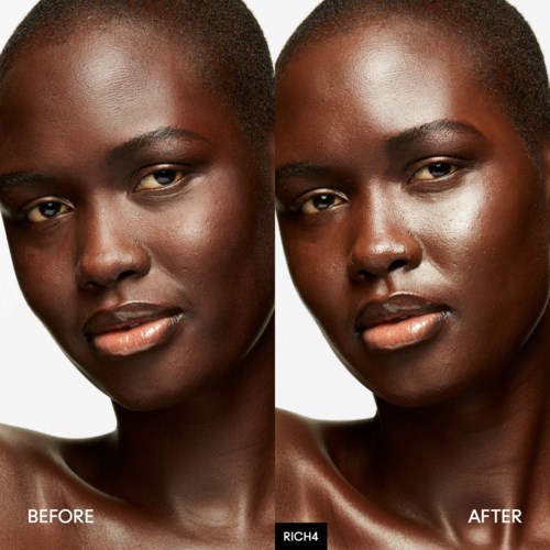 A side-by-side comparison showing before and after skincare results on a woman's face, highlighting skin clarity and glow.