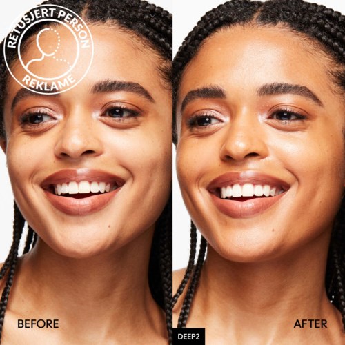 Side-by-side comparison of a woman's face before and after skin treatment showing clearer, glowing skin and a big smile.