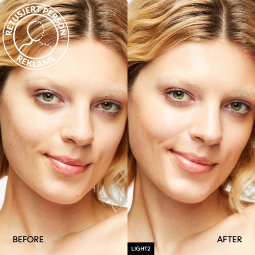 Two women, side by side, showing clear skin before and after skin treatment. One has slightly clearer complexion in the after image.