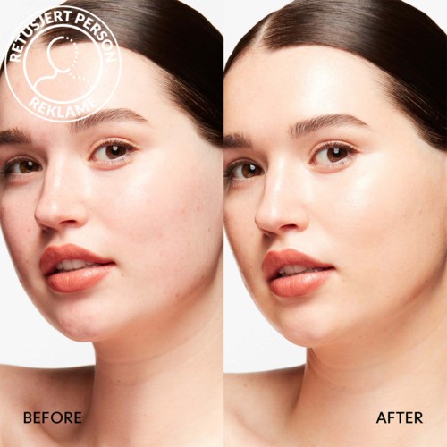 A before-and-after comparison showing clear skin improvement. The woman has smooth, bright skin after treatment.