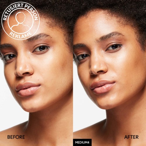 A side-by-side comparison of a woman's face showing clear skin improvement after skincare. Labels: "BEFORE" and "AFTER."