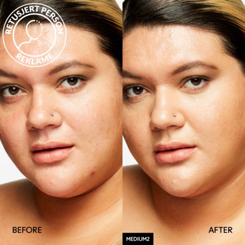 A woman shows before and after images of clearer, smoother skin with fewer blemishes and spots.