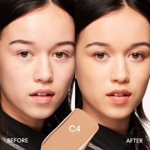 Side-by-side photos show a woman's face before and after skin treatment, with clearer skin in the after picture.