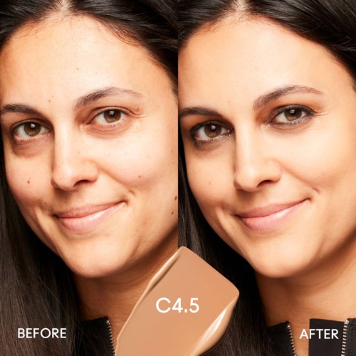 Side-by-side before and after photos of a woman showing clear skin improvement with a skincare product.