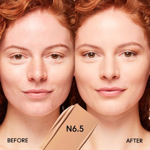 Two images of the same woman showing skin improvement after applying product N6.5.