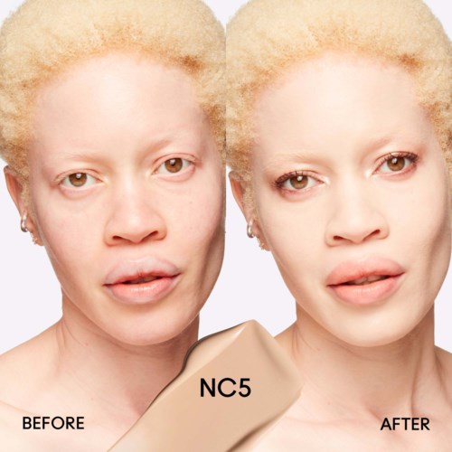 A woman with light skin and curly blonde hair, showing before and after skin treatment signs.