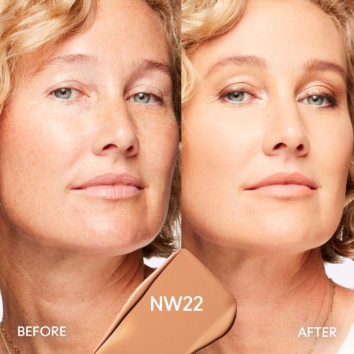 Before and after images show improved skin with less freckles and smoother appearance after using a product called NW22.