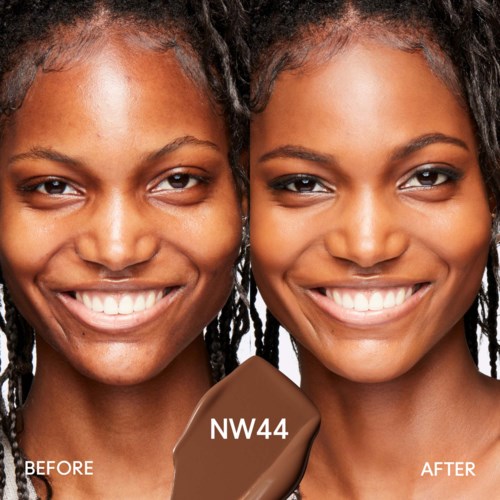 Side-by-side comparison of a woman before and after skin treatment, smiling with clear, smooth skin and natural hair.