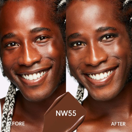 A person with a bright smile, looking into the camera, showing a successful skin treatment result.