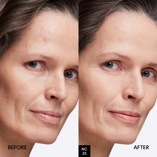 Een vrouw toont duidelijke huidverbetering na skincare-behandeling, met minder vlekken en een gladdere uitstraling.