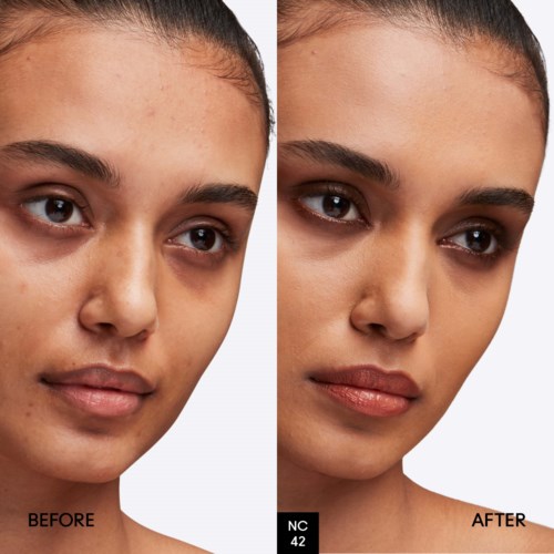 Side-by-side photos show skin improvement after treatment, with clearer, smoother skin and reduced blemishes.