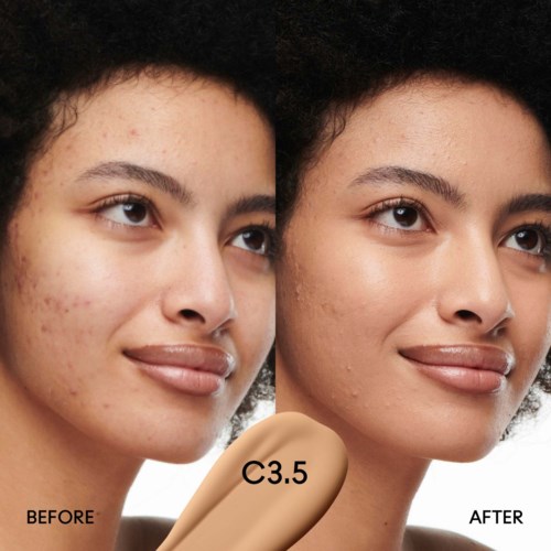 Eine Frau mit Akne vorher und klarer Haut nach Verwendung eines Hautpflegeprodukts namens C3.5. Natürlicher Look ohne Make-up.