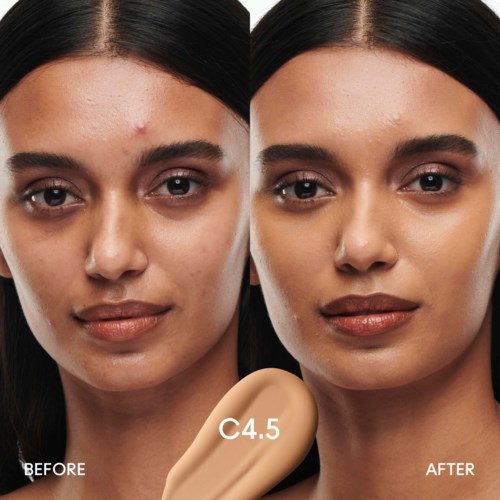 A before-and-after comparison of a woman's face showing clear skin improvement after using a skincare product.