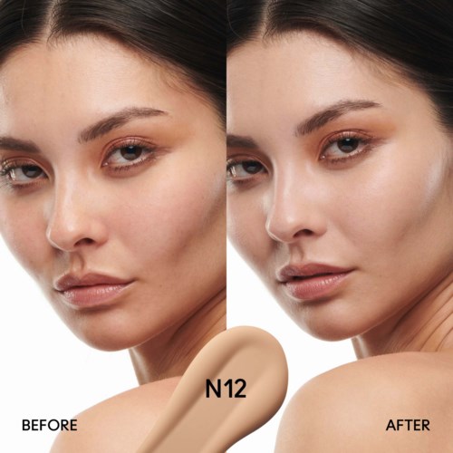 A woman shows a skin improvement before and after using N12 product. Clear skin, smooth, and radiant in the after image.