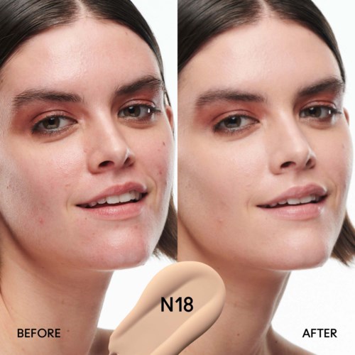 A woman shows before and after images of her skin improvement, with clearer, smoother skin after using N18.