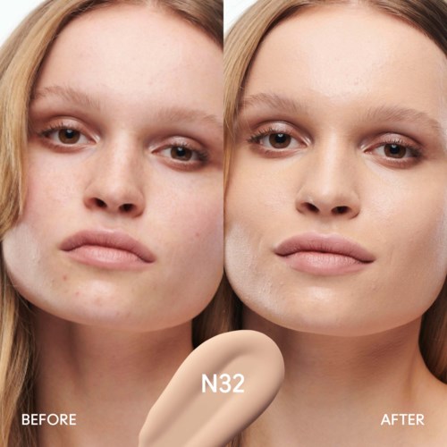Before and after images showing skin improvement, likely from a skincare product labeled N32.