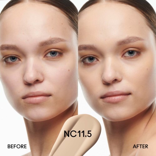 A woman with clear skin, slight makeup, before and after a cosmetic treatment, labeled NC11.5. No facial changes seen.