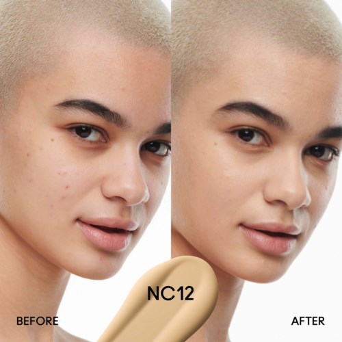 Side-by-side photos show a person's face before and after skin treatment, with clearer skin in the after photo.