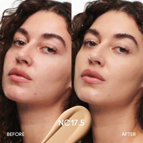 Comparison of a woman's face before and after skin treatment, showing clearer skin and smoother complexion.