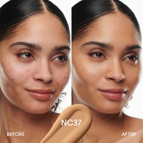 Side-by-side comparison showing skin improvement, with clearer, smoother skin after treatment or skincare. Logo at center, text highlights 'before' and 'after'.