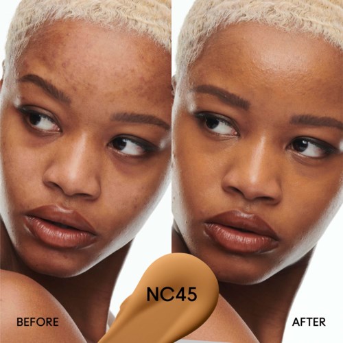 A woman's face split, showing her skin before and after applying a treatment labeled EI 45. Her skin appears clearer and smoother afterward.