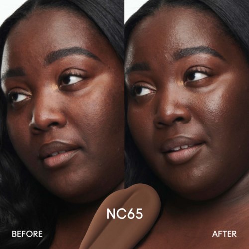 A woman with dark skin shows improved skin clarity after treatment, images labeled 'Before' and 'After'.
