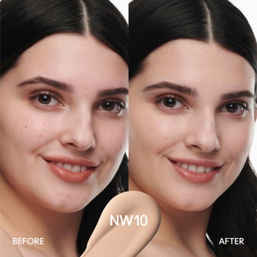 Side-by-side photos of a woman showing clear skin improvement after using a product called NW10.