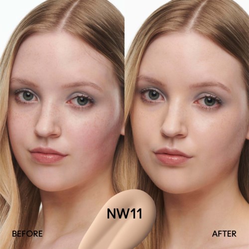 A woman with clear skin, showing before and after skin treatment results, with a label NW11. The images highlight skin improvement.